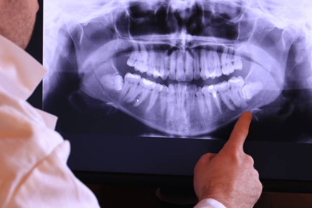 Best Emergency Dental Care for Trauma or Injury in Mitchell, NE