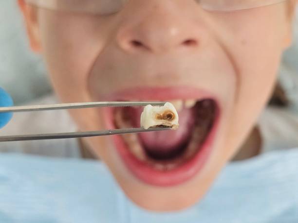 Best Weekend Emergency Dentist in Mitchell, NE